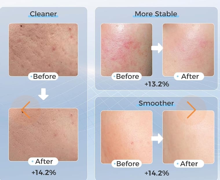 Mascara Facial LeD + SeruM de RegalO