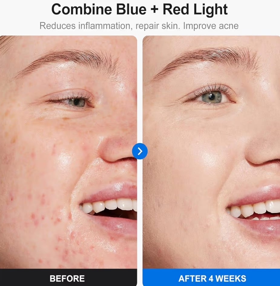 Mascara Facial LeD + SeruM de RegalO